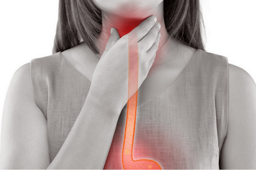 Can Acid Reflux Cause A Sore Throat image