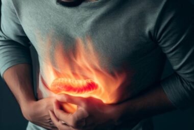 cause of heartburn and acid reflux